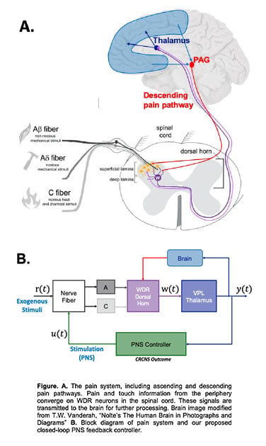 Understanding Chronic Pain - JSS Hospital